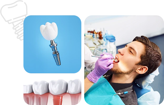 Cost of Dental Implants in Jaipur