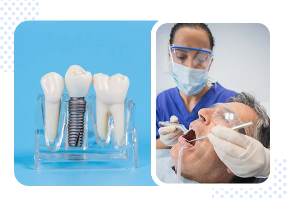 Best Dental Implant in Jaipur