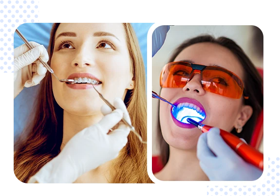 Laser Teeth Whitening Near Me