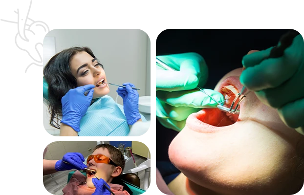 Wisdom Tooth Surgery